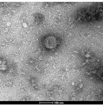 Microscopic photo of a virus