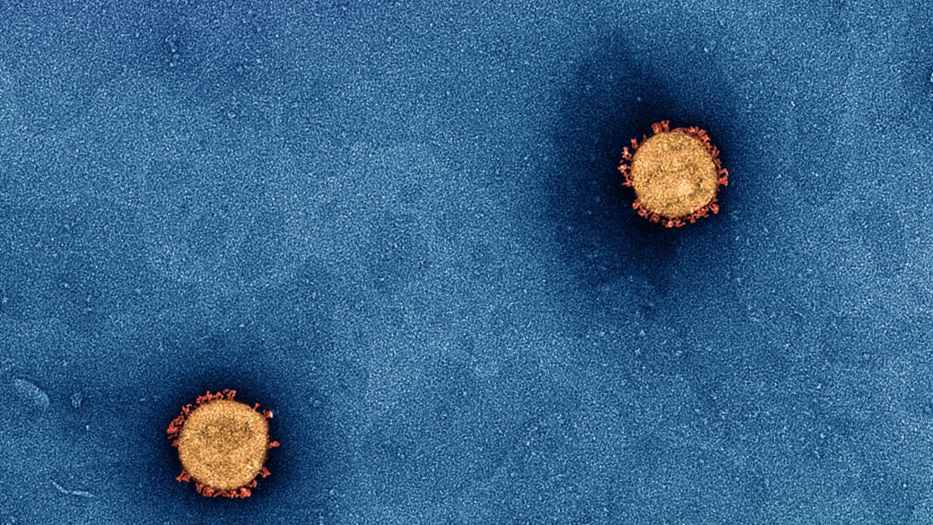 A microscopic picture of a virus surrounded by a spiky coat 