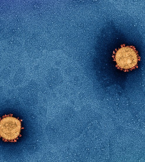 A microscopic picture of a virus surrounded by a spiky coat 