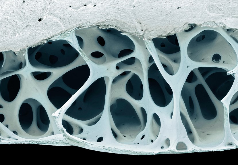 Close up of the spongy bone inside a bird skull.